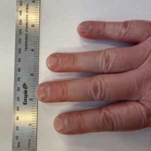 photo of fingernails from the top